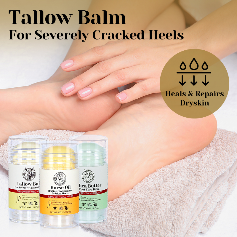 Beeswax Dead Skin Foot Callus Remover Foot Cream Care Stick Cracked Heel Repair Whipped Beef Tallow for Dry Feet - 11
